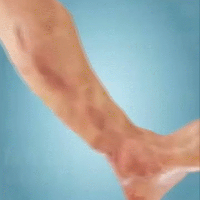 Pack 30 Parches Kinoki y adiós al malestar.