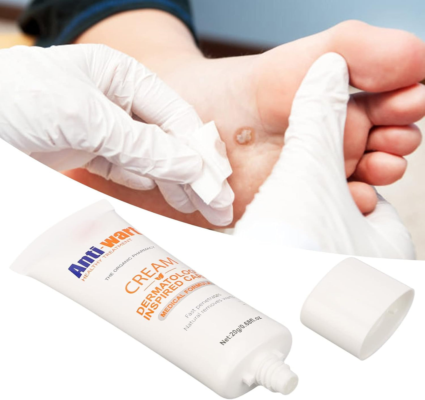 Anti-Wart® Elimina verrugas rápido y sin dolor.